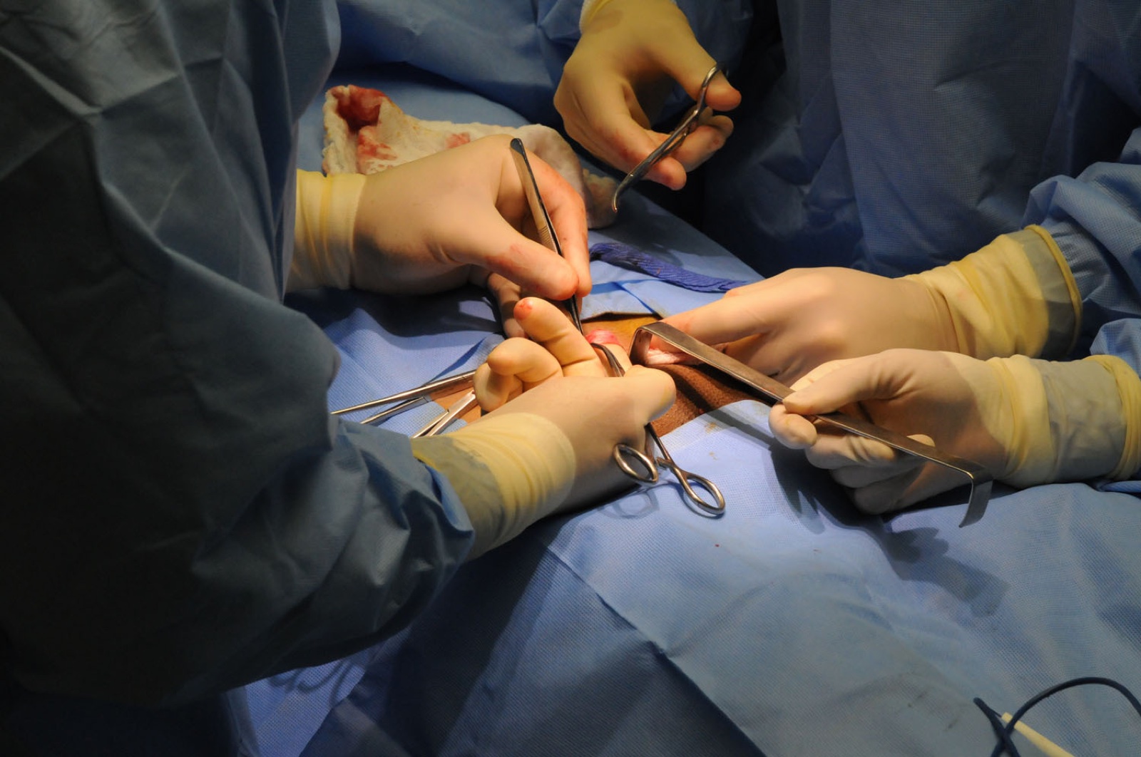 Operasi Hernia